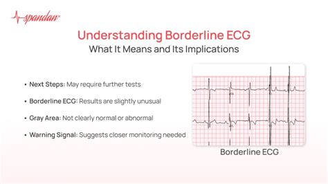 borderline ecg mayo clinic|borderline ecg definition webmd.